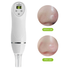 Electric pore suction and acne removing device beauty cleaner - Trending Tina